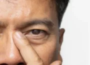 Penyebab Katarak Perlu Diwaspadai